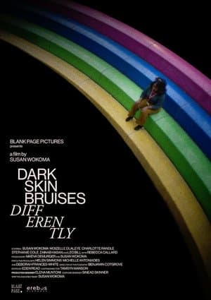 Dark Skin Bruises Differently thumbnail